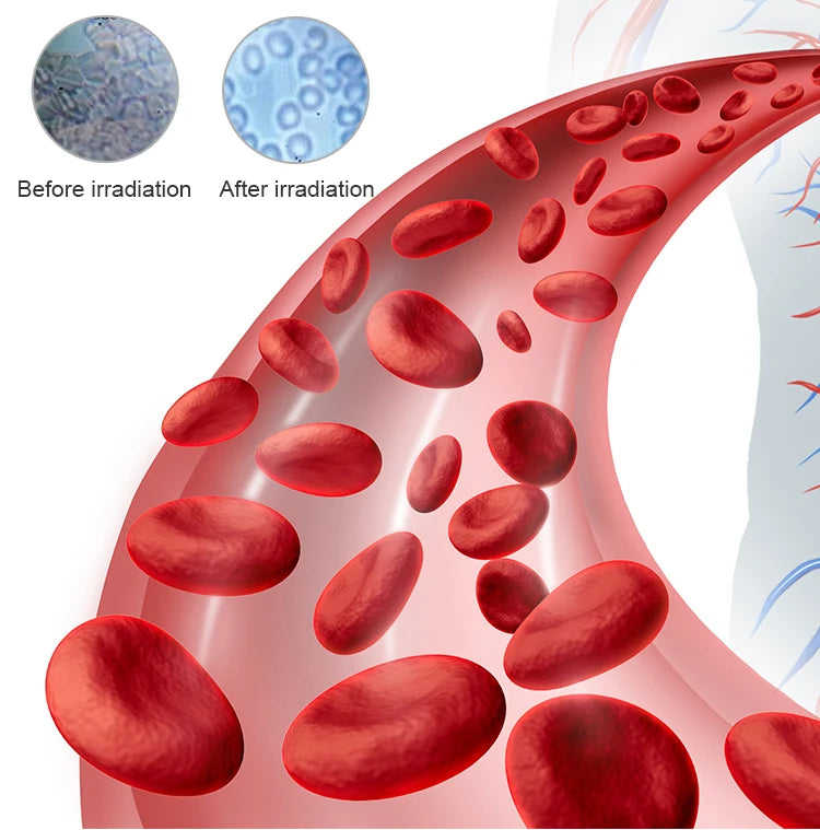 Acupuncture Moxibustion Therapy Cold Laser Diabetes